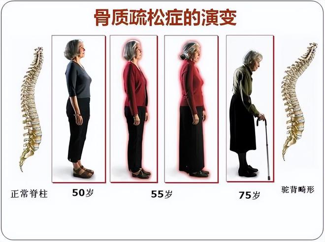 kaiyun中国官方网站坚持做“踮脚”运动的老人最后都怎样了？4大好处或许让人惊喜(图7)