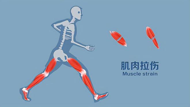 kaiyun中国官方网站坚持做“踮脚”运动的老人最后都怎样了？4大好处或许让人惊喜(图20)